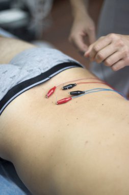 EPI Doku İçi Perkütan Elektroliz Kuru iğneleme Fizyoterapi Sırt Ağrısı Tedavisi.