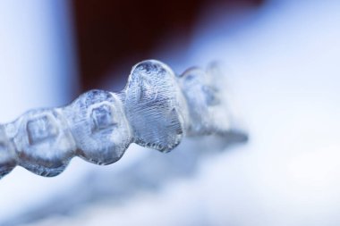 Kozmetik diş hekimliğinde hastalar için dişleri hizalamak için kullanılan görünmez diş düzenleyiciler.