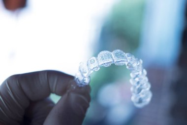 Kozmetik diş hekimliğinde hastalar için dişleri hizalamak için kullanılan görünmez diş düzenleyiciler.