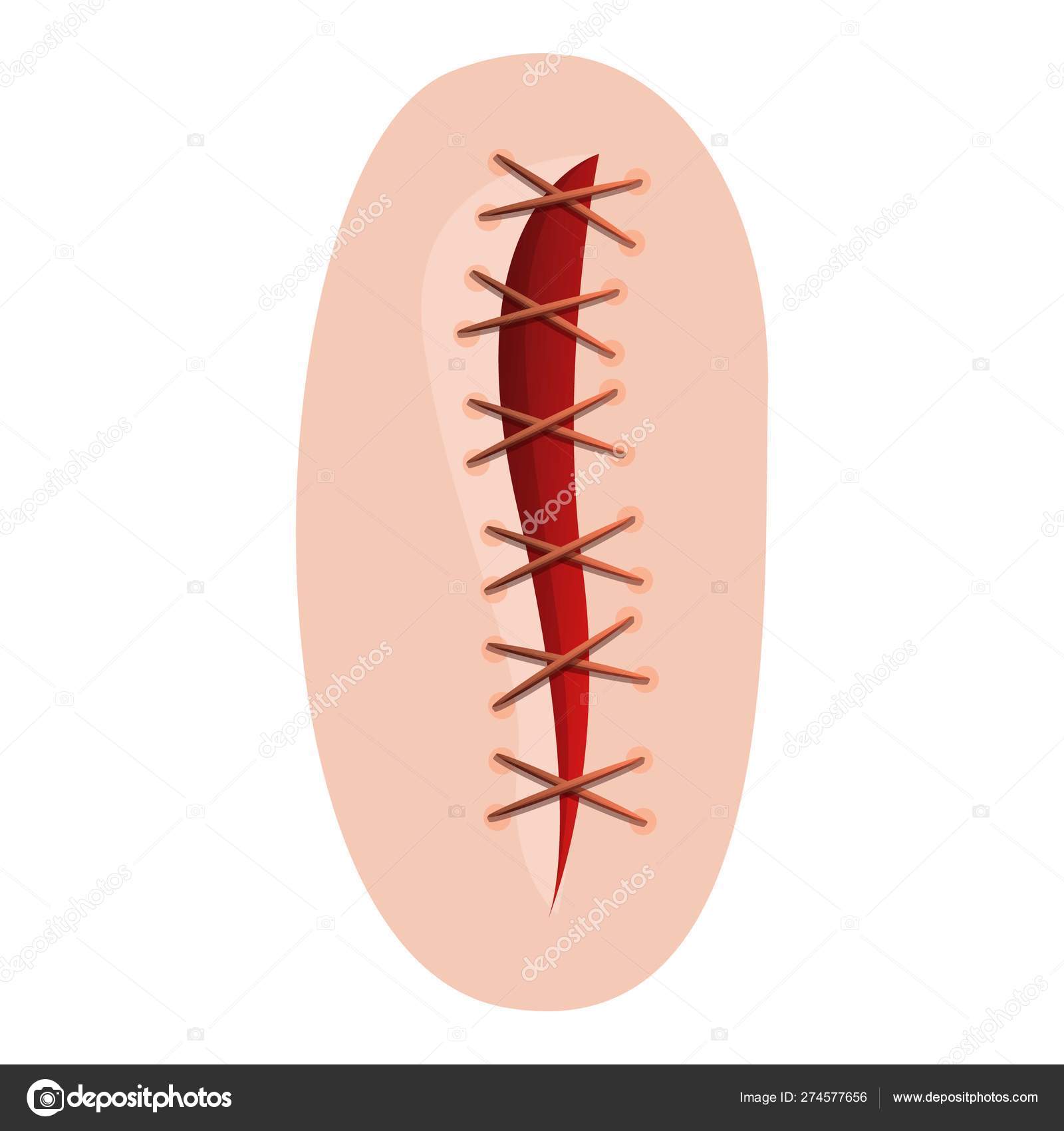 Icon: wound cartoon | Wound suture icon, cartoon style — Stock Vector