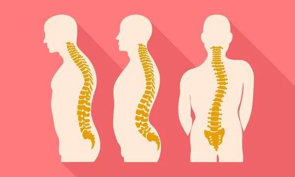 Human spine disease icon, flat style — Stock Illustration Human spine disease icon, flat style Vector Graphics