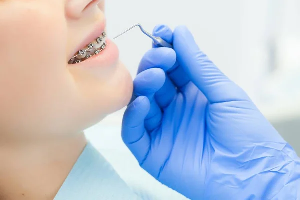 Chica con aparatos ortopédicos en la recepción en el dentista. Primer plano. Mano con el instrumento en los dientes del paciente — Foto de Stock