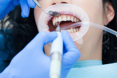 Bir kadın diş hijyenik ve diş kliniği profesyonel diş beyazlatma ve Ultrasonik Temizleme. Odontics ve ağız sağlığı.