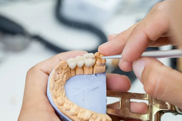 Diş teknisyeni fırça çene modeli ile çalışır — Stok fotoğraf