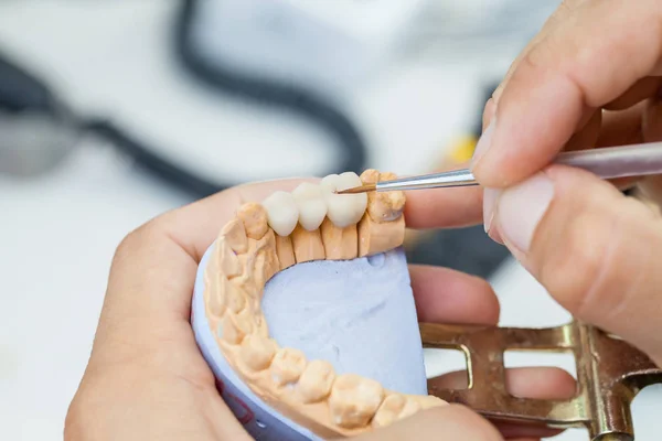 Tandteknikern arbetar med pensel med käken modell — Stockfoto
