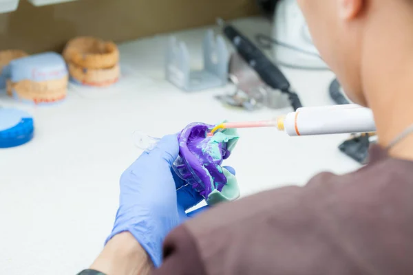 Técnico dental trabaja con un yeso de dientes en el laboratorio — Foto de Stock