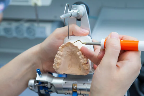Dentista-dentista trabajando con prótesis en laboratorio con cera en modelo de mandíbula en articulador — Foto de Stock