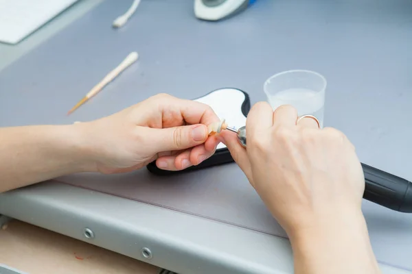 Proceso de molienda de la mandíbula durante la producción. El técnico dental procesa los dientes artificiales con un micromotor . — Foto de Stock