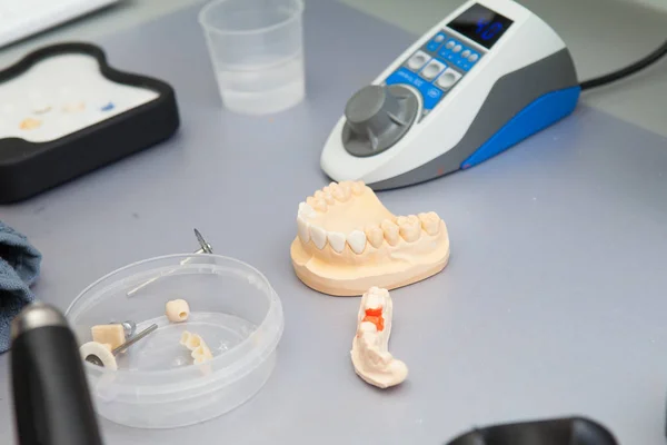 Instrumentos dentales en odontología — Foto de Stock