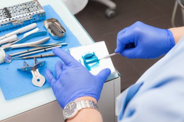 Bir ortopedi uzmanı diş hekimi diş bir çalışma modeli yapmak için bir polimer malzeme hazırlar.