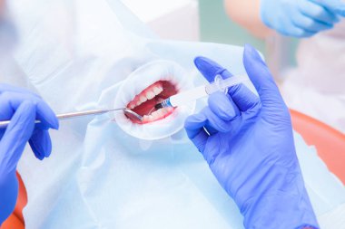 yakın çekim dişçi asistanı ile Childs'ın diş davranır, hasta yüzü kapalı