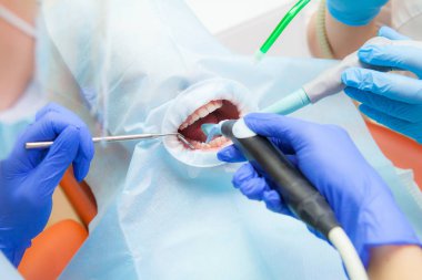 yakın çekim dişçi asistanı ile Childs'ın diş davranır, hasta yüzü kapalı