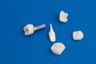 dental implant, diş kron için mavi arka plan üzerinde makro fotoğraf
