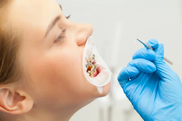 Dziewczyna z nawiasy klamrowe w recepcji u dentysty. Szczelnie-do góry. Ściśle z narzędziem o zęby pacjenta. zwijacz do jamy ustnej — Zdjęcie stockowe