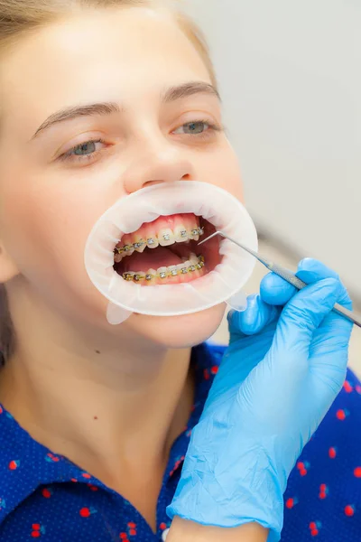 Chica con aparatos ortopédicos en la recepción en el dentista. Primer plano. Guante de mano con una herramienta en los dientes del paciente. retractor para la boca — Foto de Stock