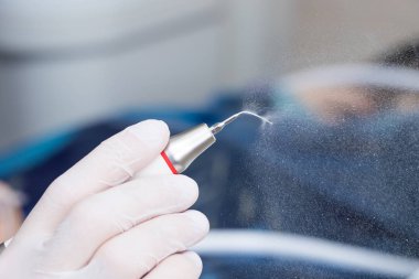 Periodontal ultrasonik ölçekleyici profilaktik ve periodontal insan dişleri - tartar Temizleme Bakımı kullanılan diş bir enstrümandır. -makro fotoğrafçılık