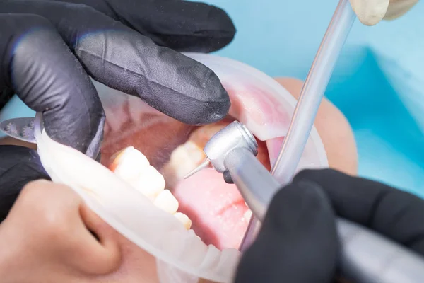 Närbild av tandläkare hand borra tänderna och spraya vattnet — Stockfoto