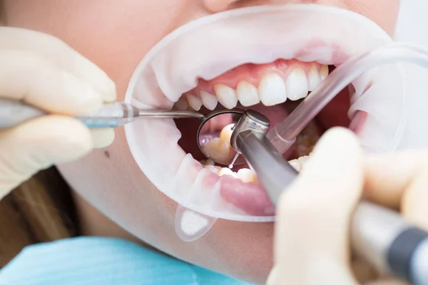 Tratamiento dental de cerca Imagen De Stock