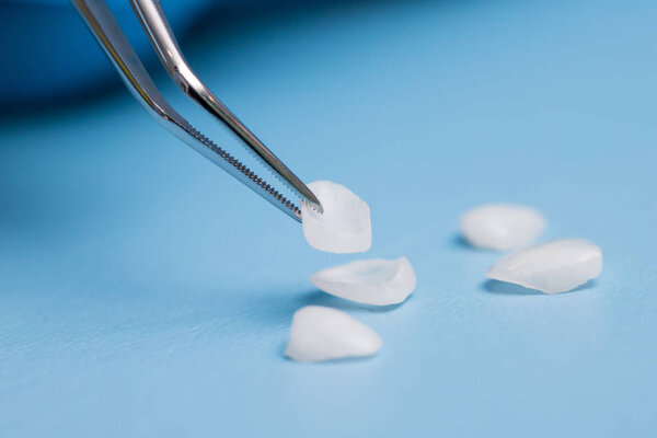 Dentist holds a veneer with tweezers against a background of lying veneers