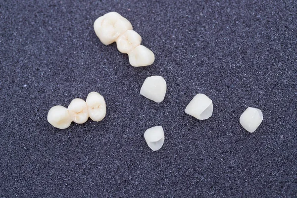 Korony ceramiczne ludzkich zębów zbliżenie makro izolat na czarnym tle. — Zdjęcie stockowe
