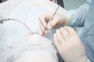 Ameliyat sırasında diş hekiminin elinde neşter. diş kliniği