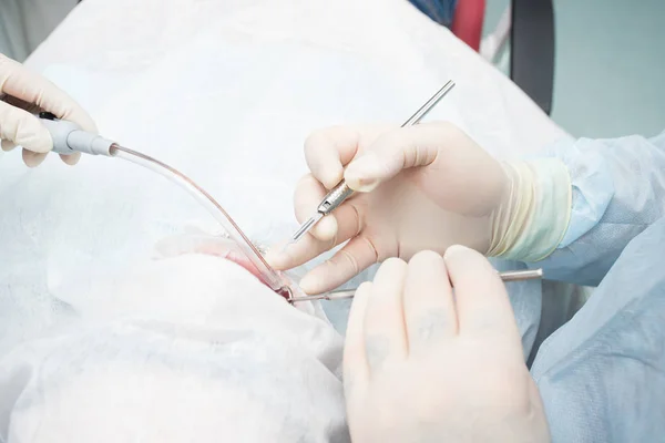 Bisturi na mão do dentista durante a cirurgia. clínica odontológica — Fotografia de Stock