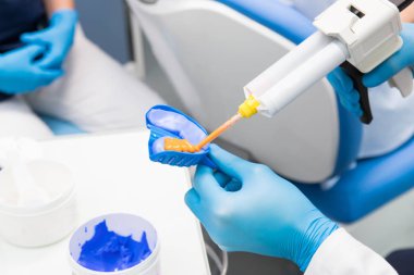 Diş hekimi diş kalıbı için malzeme hazırlar. Mavi eldivenli bir diş hekiminin yakın çekim
