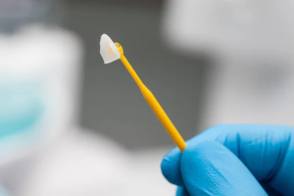 Closeup folheado cerâmico em um pau em uma mão dentista em uma luva azul . — Fotografia de Stock