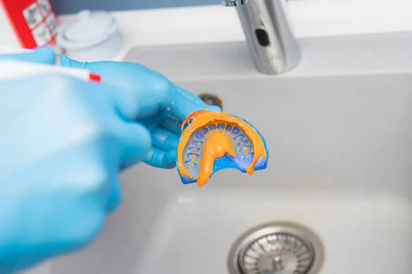 El dentista enjuaga la impresión dental con agua bajo presión. Primer plano de las manos del dentista con guantes azules — Foto de Stock