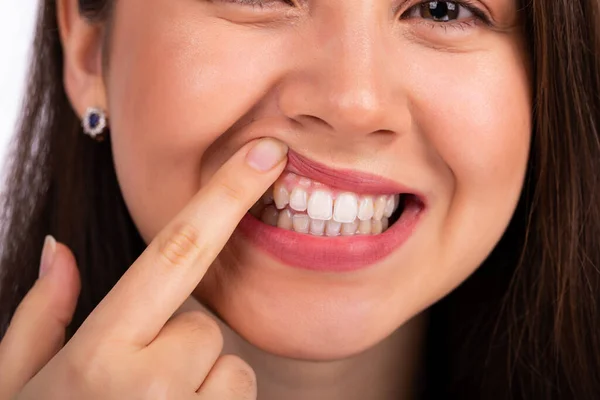 Genç ve güzel bir kadın dişlerinin üst çenesine parmağıyla dokunuyor. Dişlerinde ve diş etlerinde bir sorun var.. — Stok fotoğraf