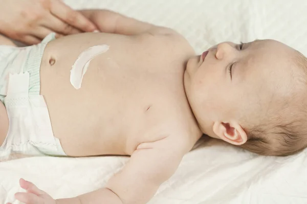 用奶油画的婴儿肚子上的微笑标志 婴儿躺在白色的床单在医生的办公室 — 图库照片