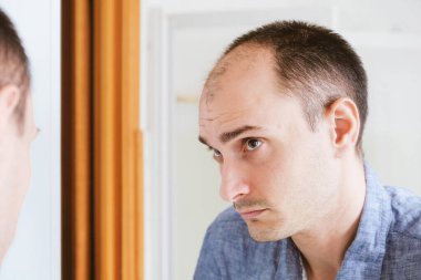 Aynaya bakan genç adam kelleşmeyi dert ediyor..