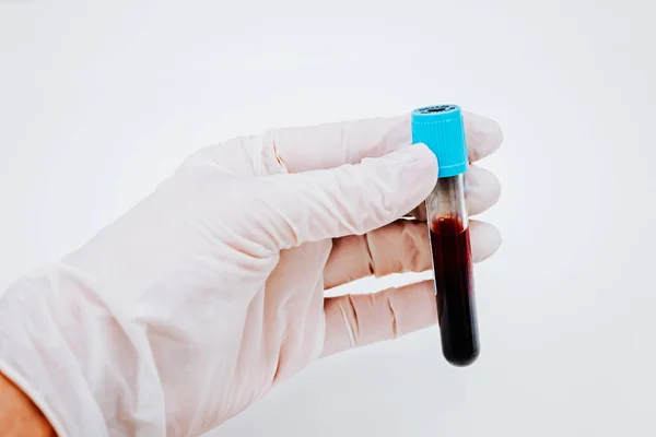 Bilim Adamı Bir Tüp Kan Örneği Ile Tutarak Teknisyen — Stok fotoğraf