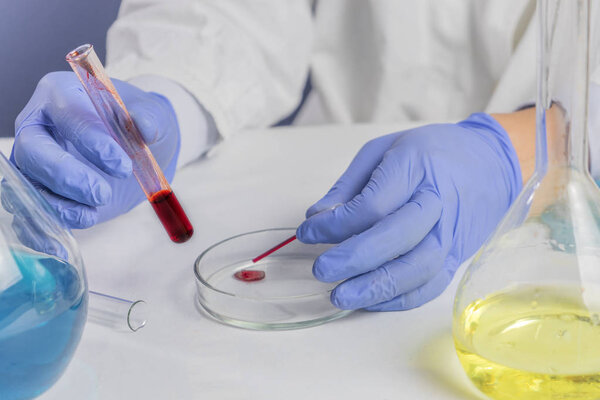 Male hands holding red blood whole blood in test tube for the sample. Health and medical, blood analyzing concept.