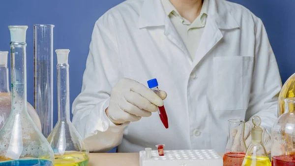 Працівник лабораторії встановлює медичний зразок крові після обстеження на відкладення — стокове фото