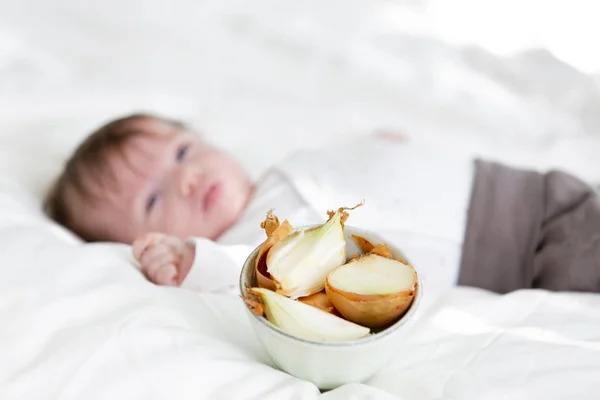 Bebé Tratado Con Aceites Esenciales Cebolla Casa Cama — Foto de Stock