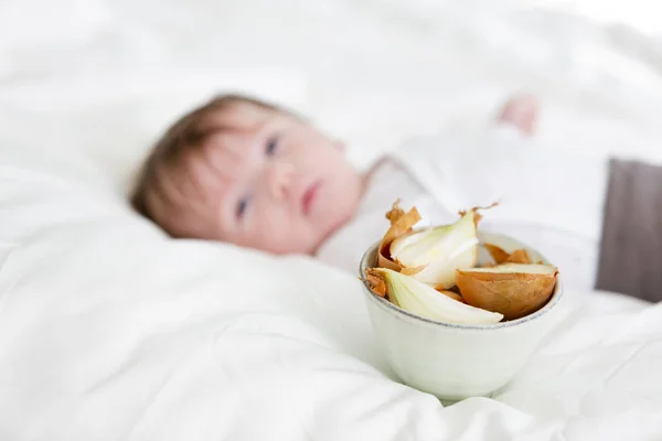 Baby Wird Hause Bett Mit Ätherischen Zwiebelölen Behandelt — Stockfoto