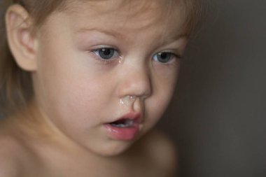 Çocuk c ile bir burun akıntısı var