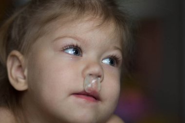 Çocuk açık sümük ile bir burun akıntısı var