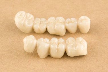 Seramik diş restorasyonu için yapılan yapay diş yapıları