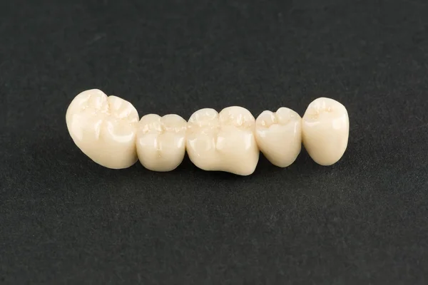 Estructuras Dentales Artificiales Cerámica Para Restauración Dentición Imágenes De Stock Sin Royalties Gratis