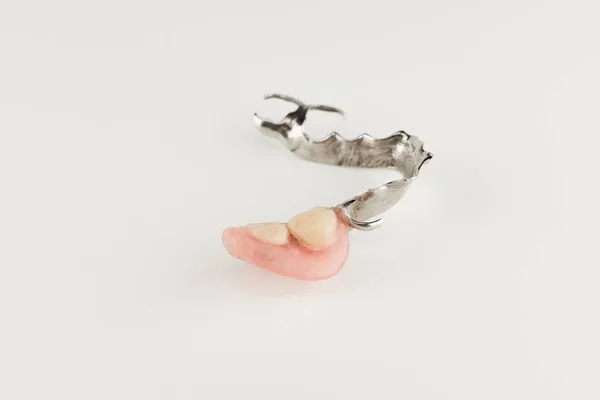 Łuk Protezy Dla Pacjentów Częściową Utratę Zębów — Zdjęcie stockowe