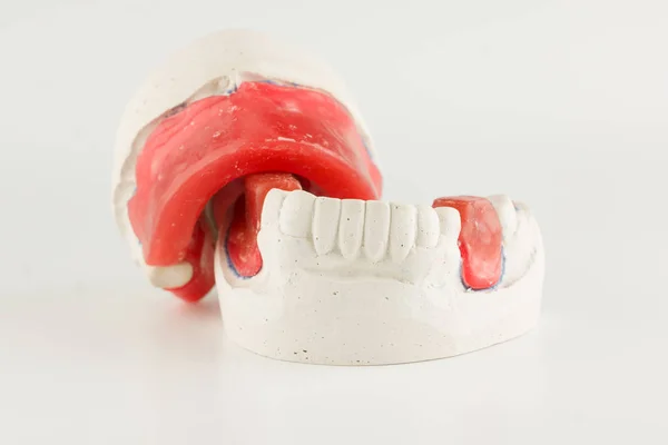 Wachsrollen Zahnmodell Zur Bestimmung Des Kieferverschlusses — Stockfoto