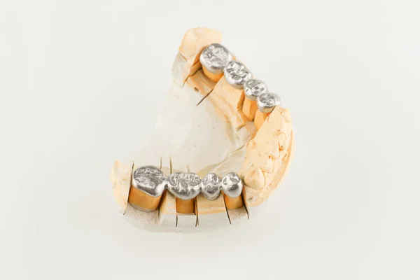 Bases Pontes Fundidas Metal Sobre Modelo Dental Artificial — Fotografia de Stock