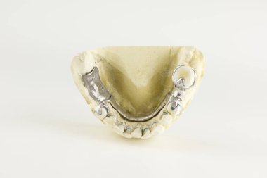 Alçı model toka protezin çelik Bankası