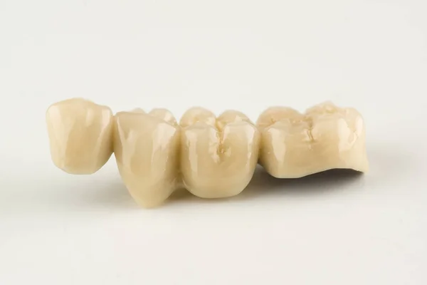 Estruturas Dentárias Artificiais Feitas Cerâmica Para Restauração Dentição — Fotografia de Stock
