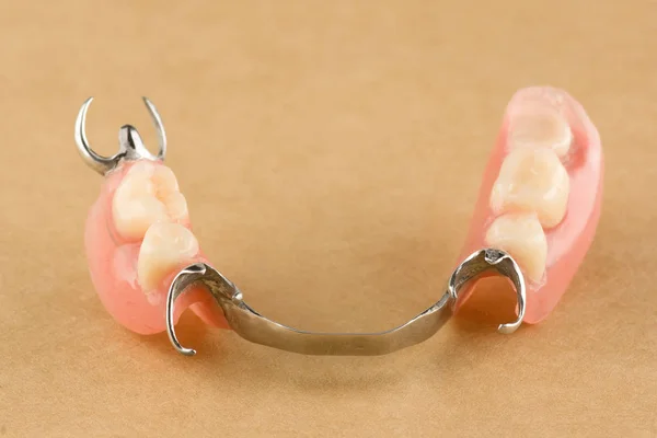 Arc Dental Prosthesis Lies Wooden Background — Stock Photo, Image