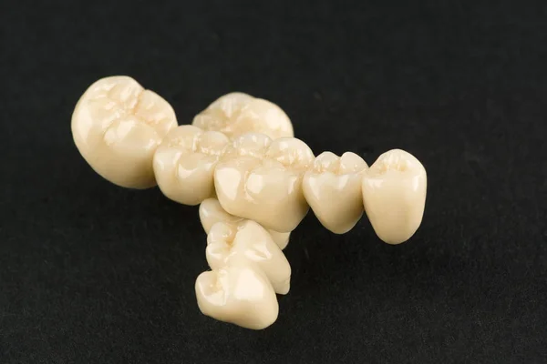 Artificial Dental Structures Made Ceramics Restoration Dentition — Stock Photo, Image