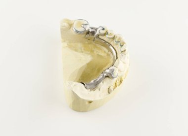 Alçı model toka protezin çelik Bankası