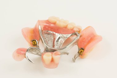 Bugel kaldırma ekleri beyaz arka plan üzerinde olan protez